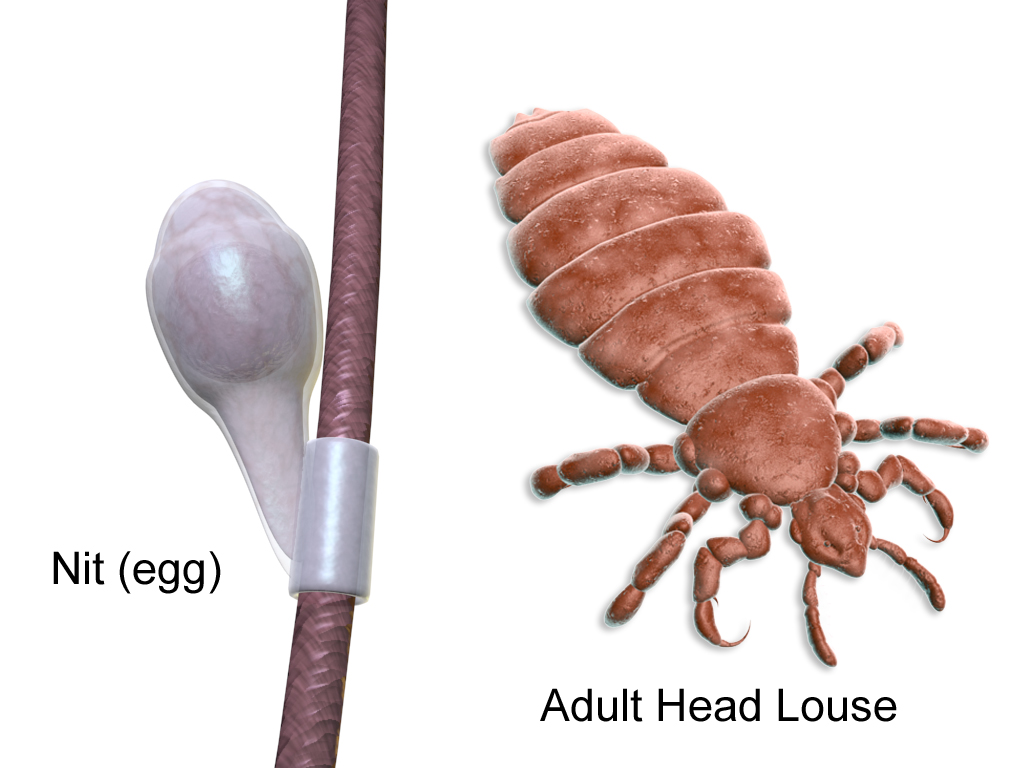 Human Head Lice: What You Need To Know - Massey Services, Inc.